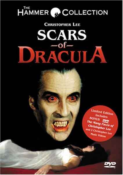Scars of Dracula (1970) Screenshot 4
