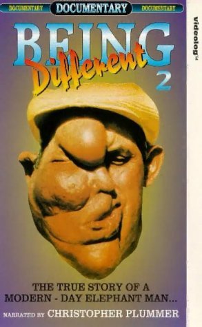 Being Different (1981) starring Billy Barty on DVD on DVD