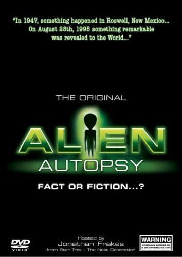 Alien Autopsy: (Fact or Fiction?) (1995) with English Subtitles on DVD on DVD