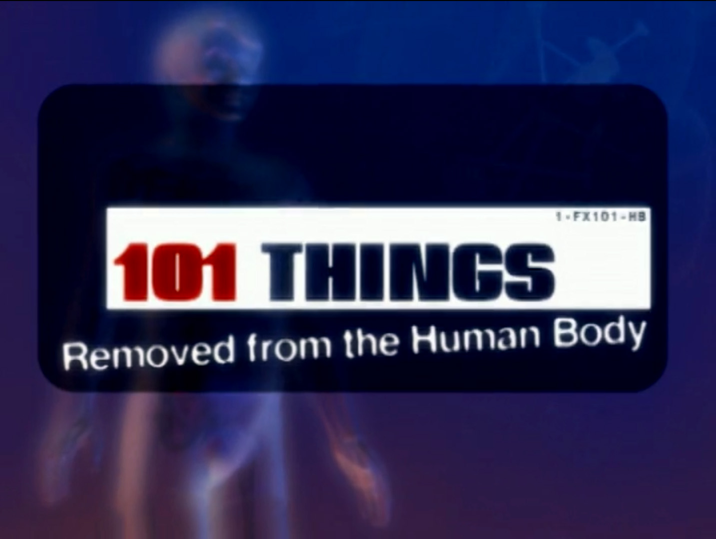101 Things Removed from the Human Body (2005) starring Mitch Lewis on DVD on DVD