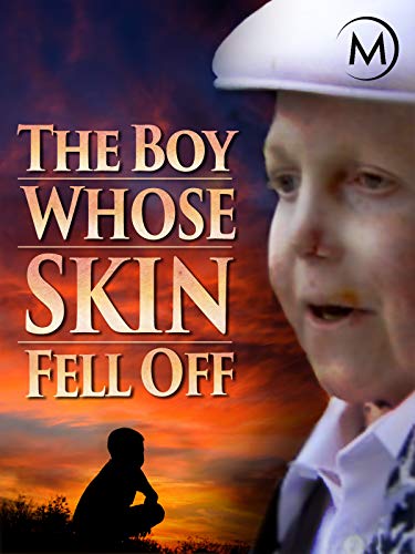 The Boy Whose Skin Fell Off (2004) Screenshot 1 
