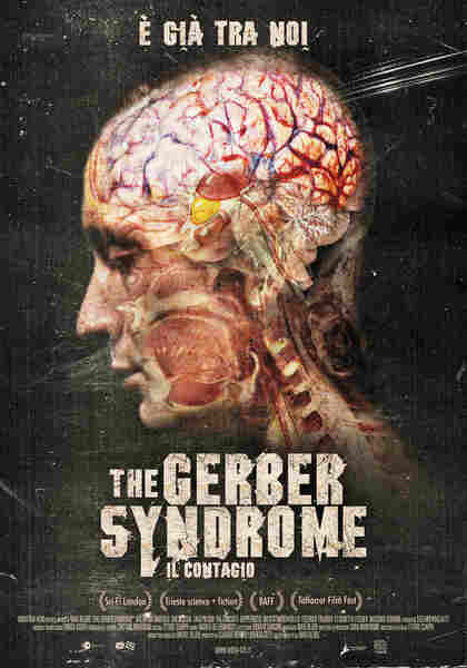 The Gerber Syndrome: il contagio (2011) Screenshot 1