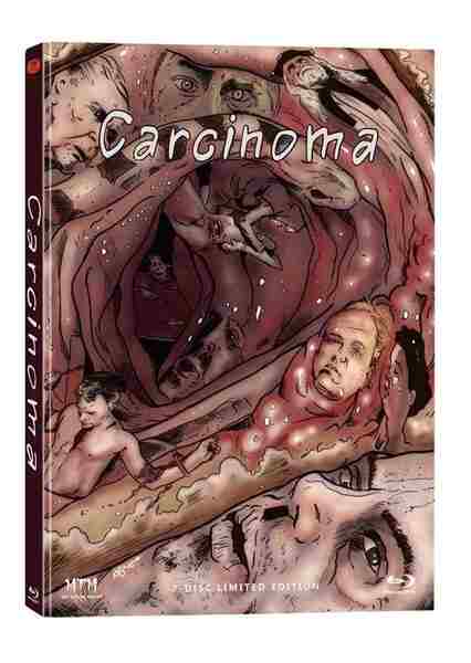 Carcinoma (2014) Screenshot 4
