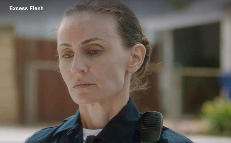 Excess Flesh (2015) Screenshot 2