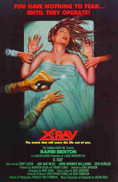 X-Ray (1981) starring Barbi Benton on DVD on DVD